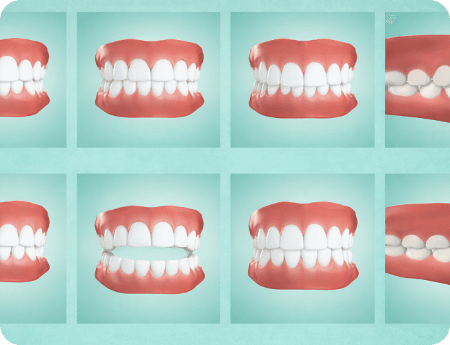 YourSmile Eligibility Grid