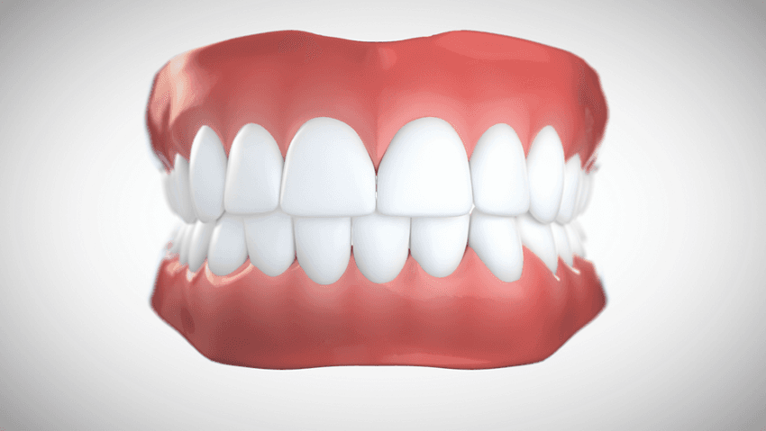 Déviation de la ligne médiane